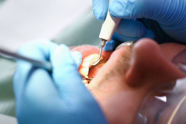 Best Broken or Cracked Tooth Emergency Dentist in Ferrysburg, MI