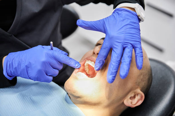 Best Emergency Dentist for Knocked-Out Tooth in Ferrysburg, MI